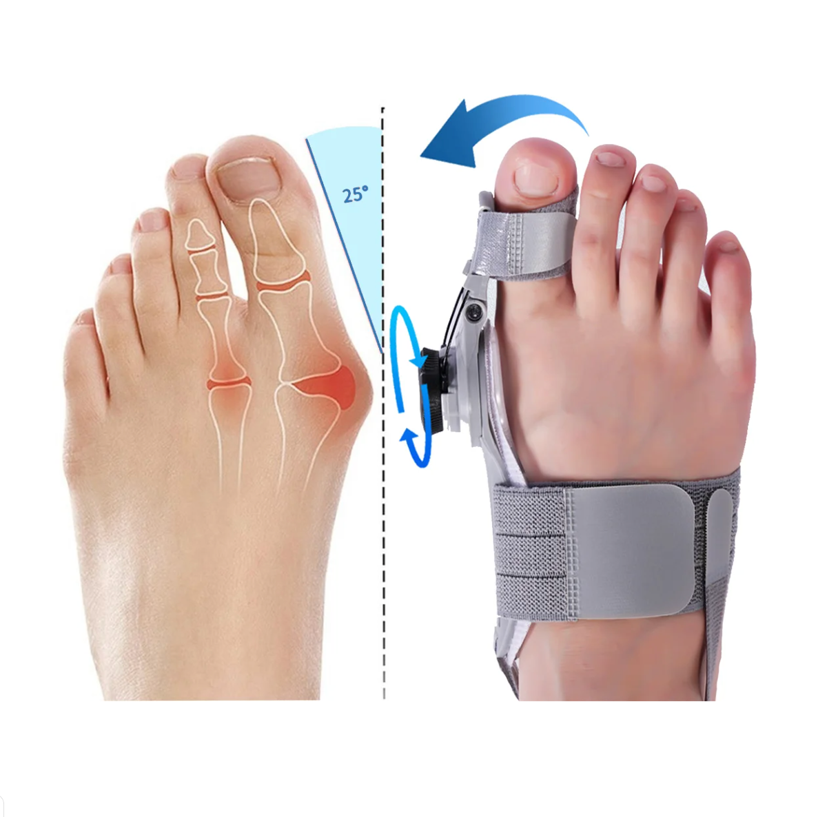 Dollyo™ ToeFix | 1+1 Gratis!